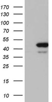 Western Blot: RMND5A Antibody (OTI2C8) [NBP2-45606]