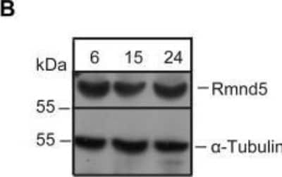 Western Blot: RMND5A Antibody [NBP1-92337]