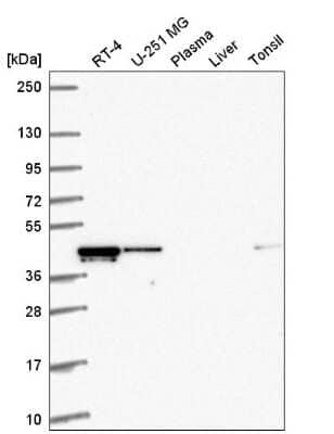 Western Blot: RMND5A Antibody [NBP2-56367]