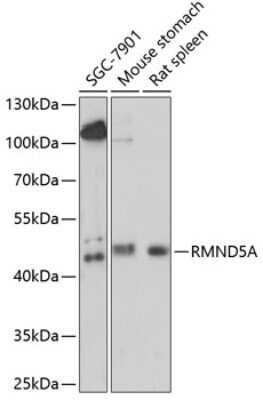 Western Blot: RMND5A AntibodyAzide and BSA Free [NBP2-94019]