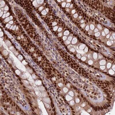 Immunohistochemistry-Paraffin: RMND5B Antibody [NBP2-13234]