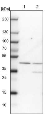 Western Blot: RMND5B Antibody [NBP2-13234]