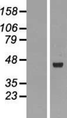 Western Blot: RMND5B Overexpression Lysate [NBL1-15390]