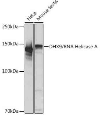 Western Blot: RNA Helicase A Antibody (2I6C5) [NBP3-16435]