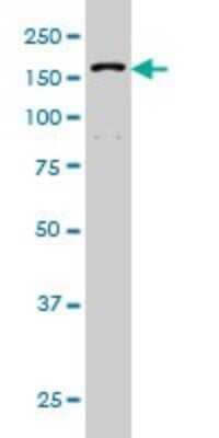 Western Blot: RNA Helicase A Antibody (3G7) [H00001660-M01]