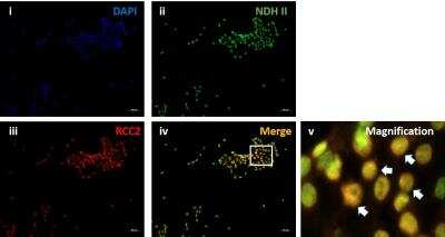 Immunocytochemistry/ Immunofluorescence: RNA Helicase A Antibody [NB110-40579]