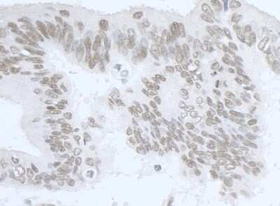 Immunohistochemistry-Paraffin: RNA Helicase A Antibody [NB110-40579]