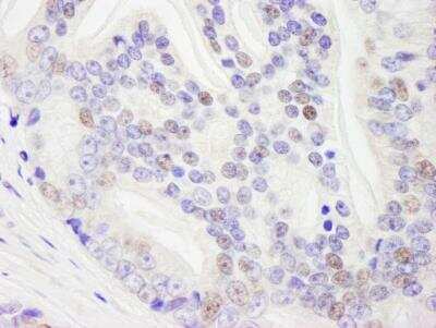 Immunohistochemistry-Paraffin: RNA Helicase A Antibody [NB110-40578]