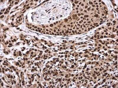 Immunohistochemistry-Paraffin: RNA Helicase A Antibody [NBP3-12975]