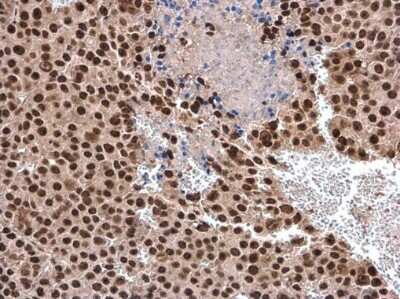 Immunohistochemistry-Paraffin: RNA Helicase A Antibody [NBP3-12975]