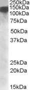 Western Blot: RNA Helicase A Antibody [NBP1-28915]