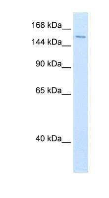 Western Blot: RNA Helicase A Antibody [NBP1-57334]