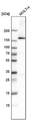 Western Blot: RNA Helicase A Antibody [NBP1-85266]