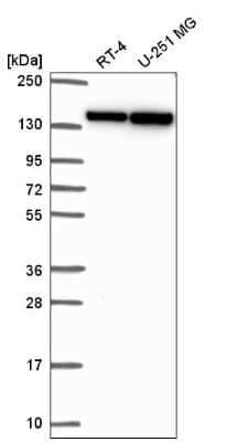 Western Blot: RNA Helicase A Antibody [NBP2-56889]