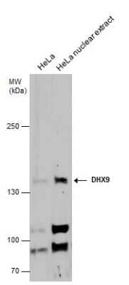 Western Blot: RNA Helicase A Antibody [NBP3-12975]