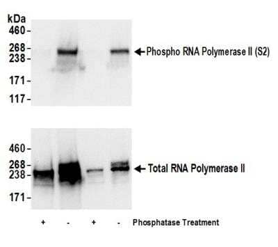 Western Blot: RNA Polymerase II/POLR2A [p Ser2] Antibody [NB100-1805]