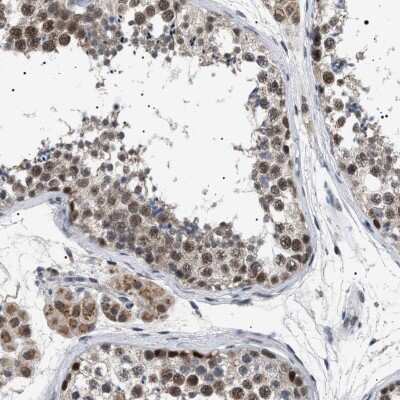Immunohistochemistry-Paraffin: RNA Polymerase II/POLR2A Antibody [NBP1-87785]