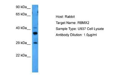 Western Blot: RNA binding motif protein, X-linked 2 Antibody [NBP2-83452]