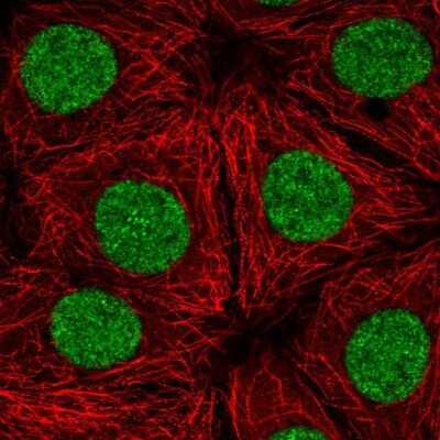Immunocytochemistry/ Immunofluorescence: RNA polymerase I termination factor Antibody [NBP2-38740]