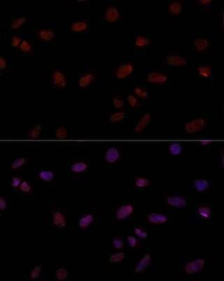 Immunocytochemistry/ Immunofluorescence: RNA polymerase I termination factor Antibody - Azide and BSA Free [NBP3-03880]