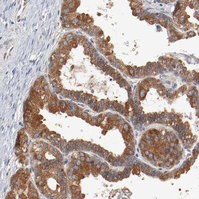 Immunohistochemistry: RNASE11 Antibody [NBP1-88423]