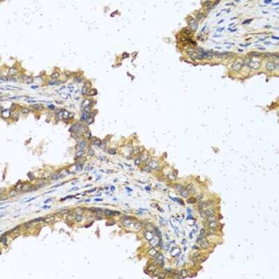 Immunohistochemistry-Paraffin: RNASE11 Antibody - BSA Free [NBP3-04501]