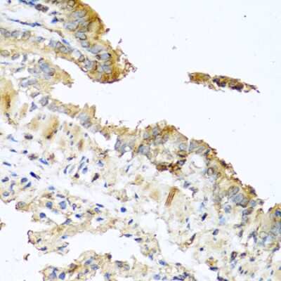 Immunohistochemistry-Paraffin: RNASE11 Antibody - BSA Free [NBP3-04501]