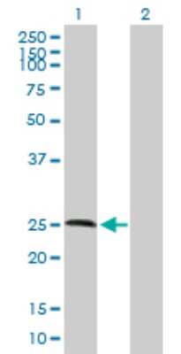 Western Blot: RNASE11 Antibody [H00122651-B01P]