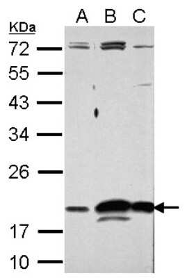 Western Blot: RNASE11 Antibody [NBP2-20172]