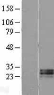 Western Blot: RNASE11 Overexpression Lysate [NBL1-15393]