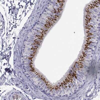 Immunohistochemistry-Paraffin: RNASE12 Antibody [NBP1-94162]