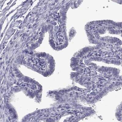 Immunohistochemistry-Paraffin: RNASE12 Antibody [NBP1-94162]