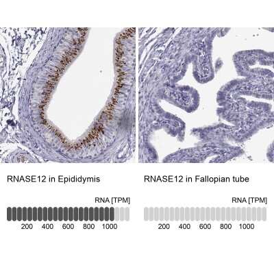 Immunohistochemistry-Paraffin: RNASE12 Antibody [NBP1-94162]