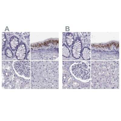 Immunohistochemistry-Paraffin: RNASE12 Antibody [NBP1-94162]