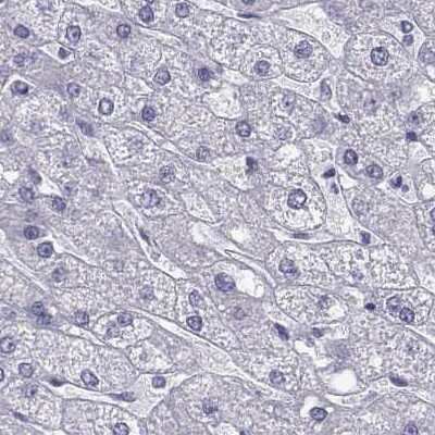 Immunohistochemistry-Paraffin: RNASE12 Antibody [NBP1-94162]