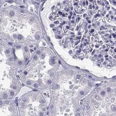 Immunohistochemistry-Paraffin: RNASE12 Antibody [NBP1-94162]