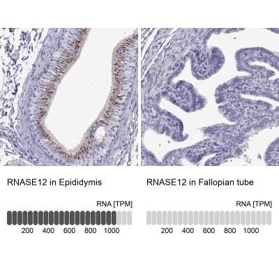Immunohistochemistry-Paraffin: RNASE12 Antibody [NBP2-62631]