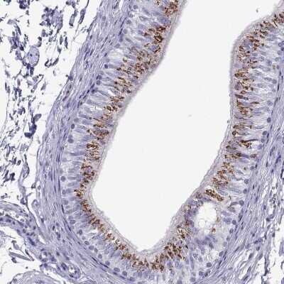 Immunohistochemistry-Paraffin: RNASE12 Antibody [NBP2-62631]