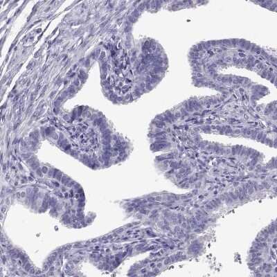 Immunohistochemistry-Paraffin: RNASE12 Antibody [NBP2-62631]