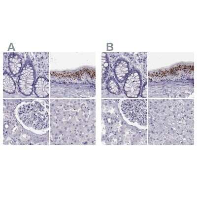 Immunohistochemistry-Paraffin: RNASE12 Antibody [NBP2-62631]