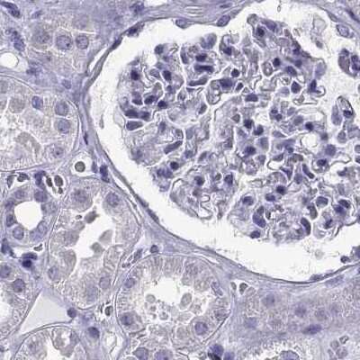 Immunohistochemistry-Paraffin: RNASE12 Antibody [NBP2-62631]