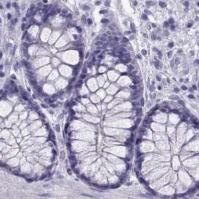 Immunohistochemistry-Paraffin: RNASE12 Antibody [NBP2-62631]