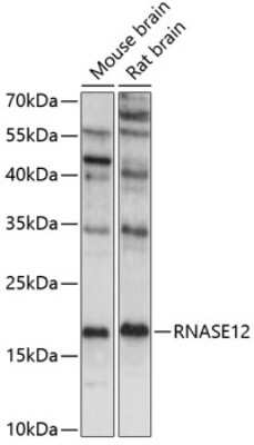 Western Blot: RNASE12 AntibodyAzide and BSA Free [NBP2-93730]