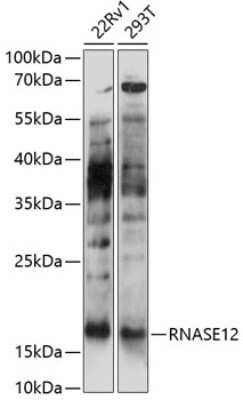 Western Blot: RNASE12 AntibodyAzide and BSA Free [NBP2-93731]