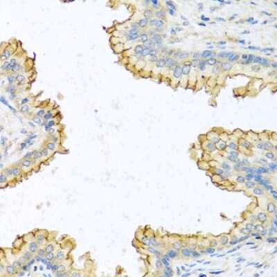 Immunohistochemistry-Paraffin: RNASE13 Antibody - BSA Free [NBP2-94210]