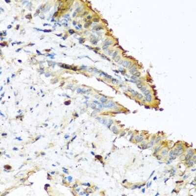 Immunohistochemistry-Paraffin: RNASE13 Antibody - BSA Free [NBP2-94210]