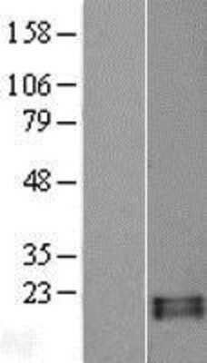 Western Blot: RNASE13 Overexpression Lysate [NBL1-15394]