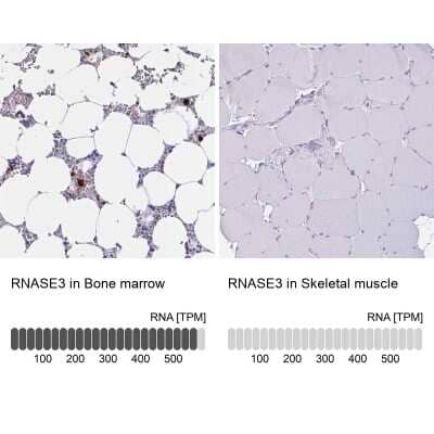 Immunohistochemistry-Paraffin: RNASE3 Antibody [NBP2-33778]