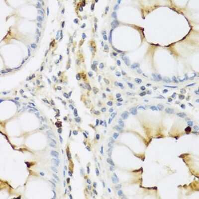 Immunohistochemistry-Paraffin: RNASE3 Antibody - BSA Free [NBP2-93655]