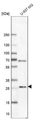 Western Blot: RNASE3 Antibody [NBP2-33778]